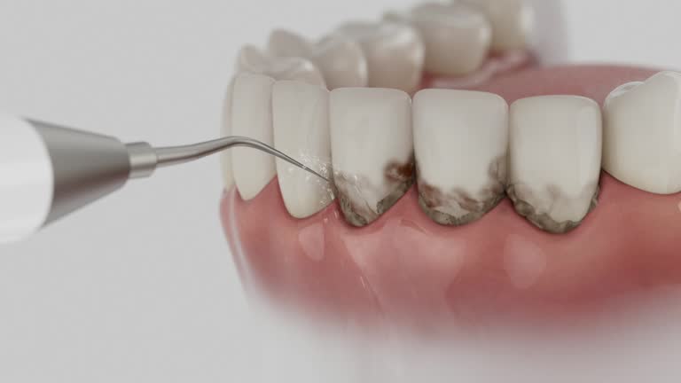 Reliable Dental contractor in Wolfforth, TX by Smile Center Dentistry